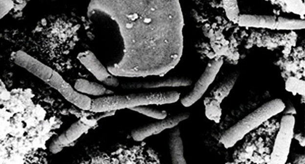 Bacteria of Siberian plague. Source: http://ru.wikipedia.org