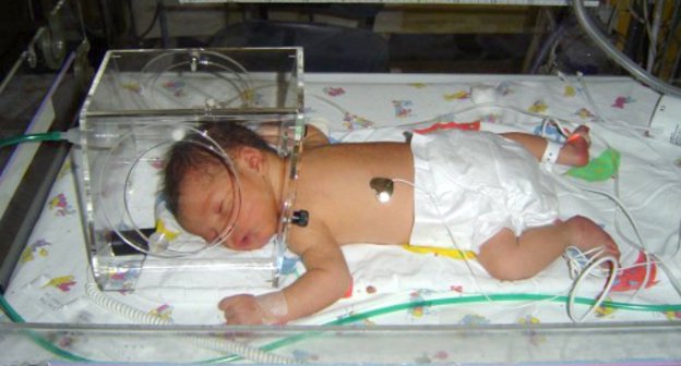 Newborn in incubator. Photo by croftsfamily.com