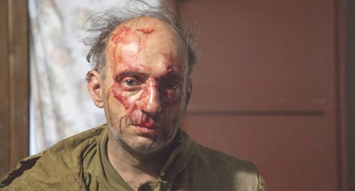 Mikhail Kreyndlin, one of the  "Greenpeace" activists, after being attacked. Photo: Greenpeace.org