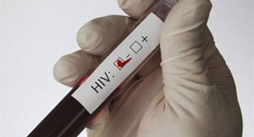 HIV blood test. Photo: http://www.spid.ru/spid/ru/news?page=14