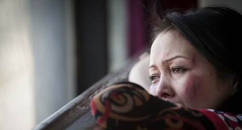 A woman with traces of beatings. Photo: RFE/RL, https://rus.azattyk.org/