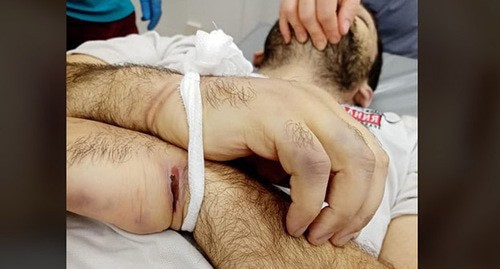 Traces of severe beatings on Inal Djabiev's body. Screenshot https://www.facebook.com/photo/?fbid=946507415829604&amp;set=pcb.2721689724815819