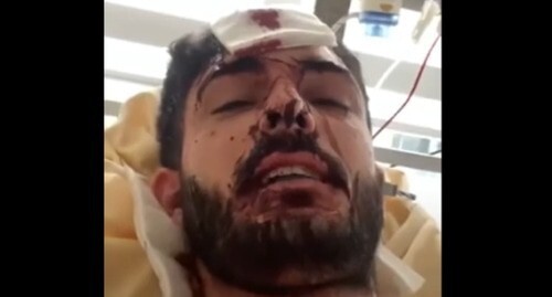 Mukhammed Mirzali after being attacked. Screenshot of the video at the Amon Equalizer YouTube channel https://www.youtube.com/watch?v=nVEhi45e3vg