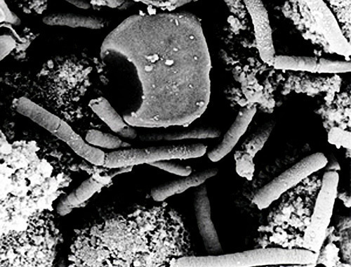 Bacteria of Siberian plague. Source: http://ru.wikipedia.org