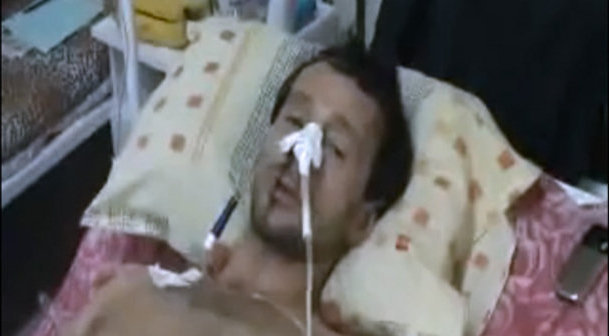 Vyacheslav Merekha after attack on him. Screenshot from a video cilp at www.youtube.com