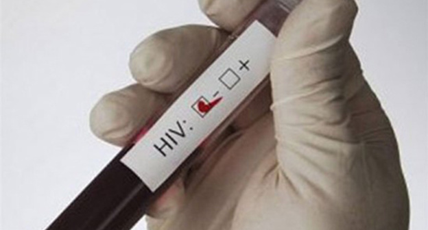 HIV blood test. Photo: http://www.spid.ru/spid/ru/news?page=14 HIV blood test. Photo: http://www.spid.ru/spid/ru/news?page=14