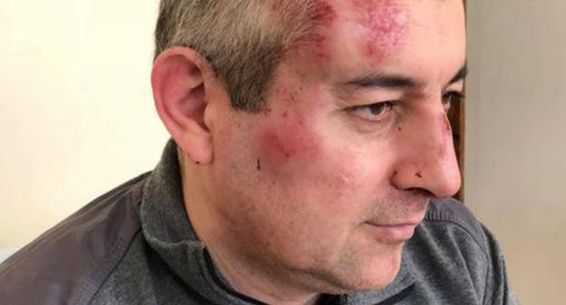 Sirazhudin Datsiev. Photo: Ekaterina Sokiryanksaya (RFE/RL) Sirazhudin Datsiev. Photo: Ekaterina Sokiryanksaya (RFE/RL)