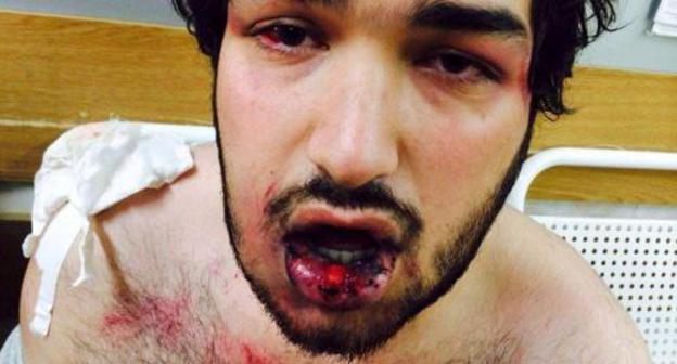 Murad Ragimov after detention. Photo: Change.org Murad Ragimov after detention. Photo: Change.org