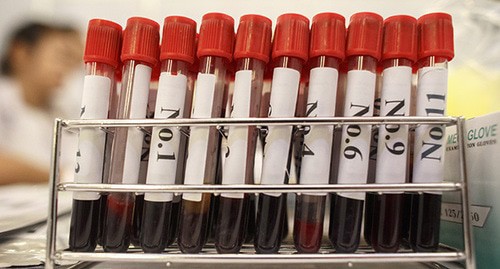Tubes with blood samples for HIV testing. Photo: REUTERS/Athit Perawongmetha