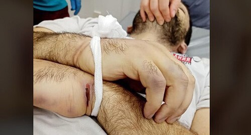 Traces of torture on Inal Djabiev's body. Screenshot https://www.facebook.com/photo/?fbid=946507415829604&amp;set=pcb.2721689724815819