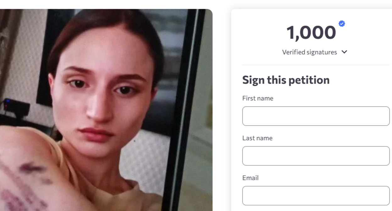 Petition page demanding an investigation into the death of Aishat Baimuradova, https://www.change.org/p/justice-for-aishat-call-on-armenia-for-a-transparent-investigation

